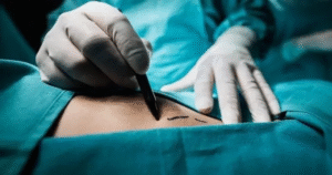 Trafficking victims in Myanmar forced to sell organs: charity