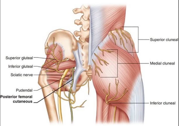 Hidden Nerves, Hidden Pain: A Doctor’s Journey Through Sciatica and Cluneal Nerve Entrapment